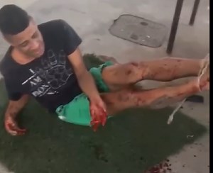 Thief gets the hammer treatment