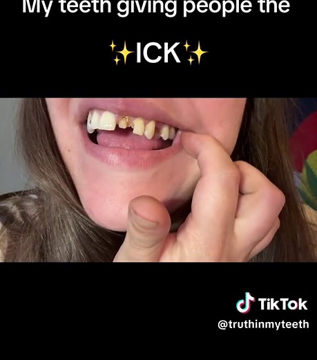Bad Teeth - What You Need to Know