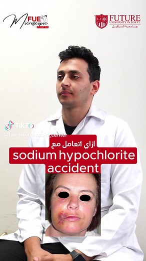 How to Manage Sodium Hypochlorite Accidents | Dr. Ahmed Ali