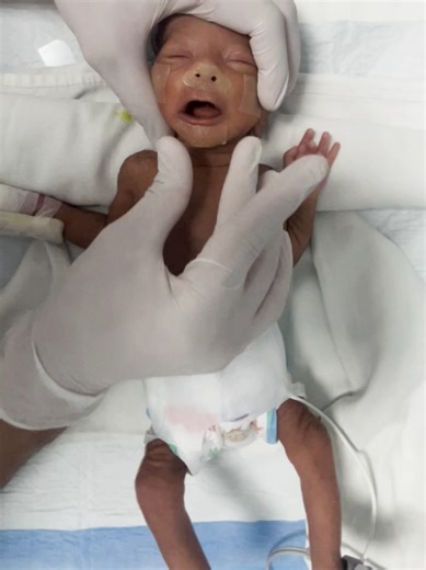 Newborn Baby's First Breath: A Heartwarming Moment