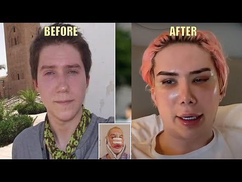 Oli London Decides To Change His RACE to Become Korean.... (this is Getting out of Hand)