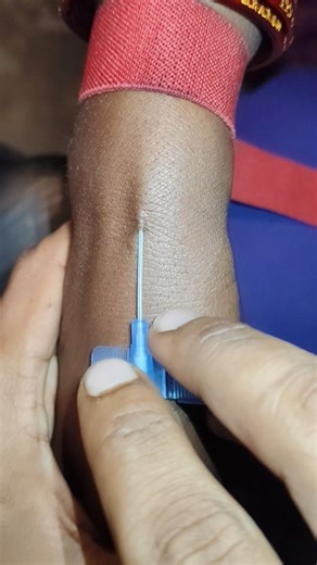 IV cannulation procedure | IV cannulation Technique | iv cannula kaise lagate hain #shorts#doctor