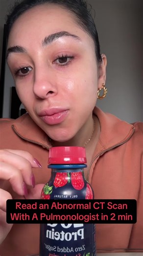 Understanding Abnormal CT Scan Findings in Pulmonary Cases