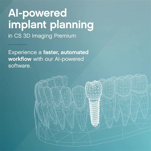 🚀 Significantly accelerate your implant workflow with AI automation. By reducing the most time-consuming parts of planning, you can present treatment options to patients sooner. Which will have your patients saying “yes” to their treatment journey even faster. *Automated implant placement currently limited to a maximum of three teeth in the mandibular region. Initial proposal should be controlled by the clinician and might require some adjustments by the clinician. 💡 For more details and inspi