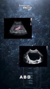 1.1K views | What Makes an Ultrasound Truly All-in-One? 樂 A system...
