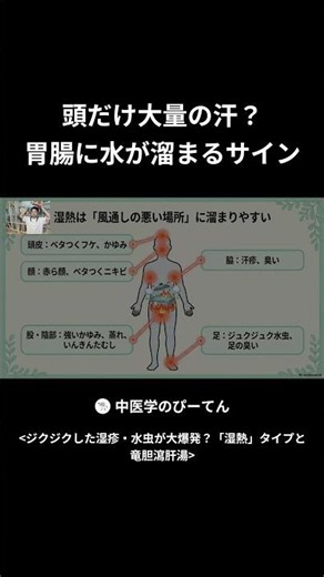 Sweating Heavily Only from Your Head? A Sign of Fluid Buildup in Your Gut