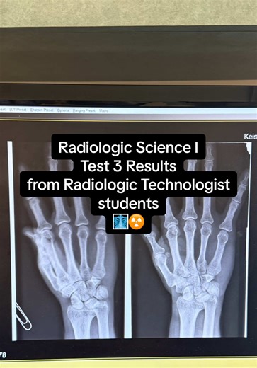 Radiologic Science Test Results Impact on Students