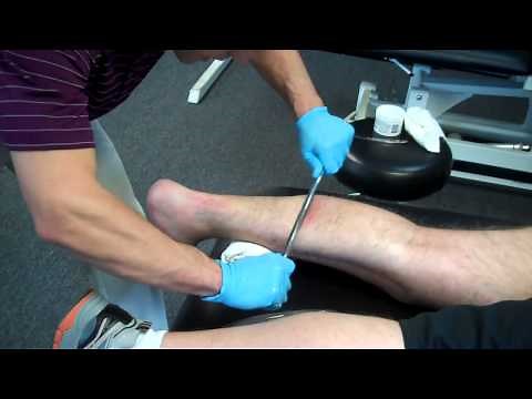 Graston Technique - Foot & Plantar Fasciitis