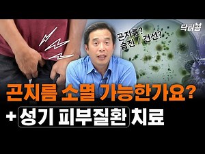 곤지름 소멸 가능할까요? 성기 주변 피부 질환-서울대 전문의