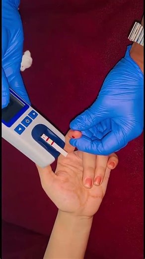 How to do Hemoglobin blood test #bloodtest #diagnosticlab #dirghayulab#profile