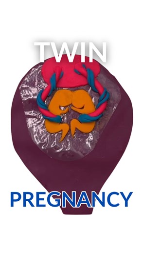 Twin pregnancy has always really intrigued me! Are you expecting twins? Or do you already have twin babies, or multiples? Heres a little info on types of twins in utero ♥️♥️ **for informational purposes only** #twinsoffacebook #twinpregnancy #expectingtwins #twins #multiples #multiplepregnancy #twinmom #birthprep | Mama Nurse Tina