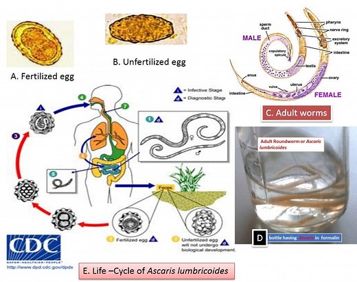 Ascaris: Introduction, Morphology, life cycle, mode of infection, Pathogen