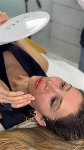 ✨Pentru ca întotdeauna știm ce să vă recomandăm, după tratamentul cu Dermapen 4, i-am recomandat Silviei reconturarea buzelor cu fire PDO și 1 ml de AH pentru augmentare și hidratare. ✨Urmăriți video pentru rezultat ❤️ 💁🏻‍♀️Programează-te și tu! 📞0722.296.007 📍Str. Gheorghe Țițeica, nr. 92A 🌐www.beautyartaesthetics.ro #plasticsurgery #plasticsurgeon #cosmeticsurgery #beauty #liposuction #surgery #lipo #tummytuck #botox #bbl #beforeandafter #chirurgie #facelift #skincare #aesthetics #surgeon
