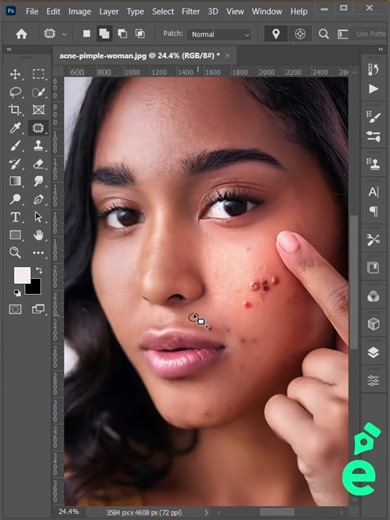 Remove Pimples in Minutes using Photoshop Easy!