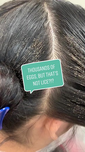 Effective Lice Removal: Preventing Infestations and Ensuring Lice Don't Mate