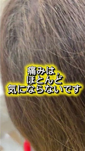 【患者さんの本音】「思ったより全然楽でした」普通なら抜歯と言われる歯をレーザー治療した感想