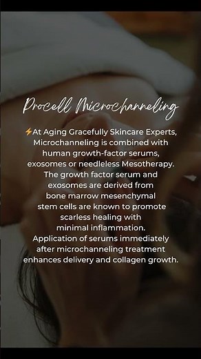 Procell Microchanneling: collagen induction therapy