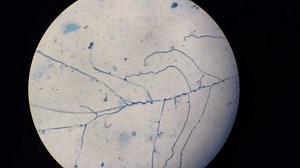 Microscopic Examination Candida Albicans Found Budding Stock Footage Video (100% Royalty-free) 3566912671 | Shutterstock