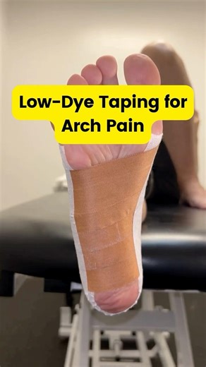 Low-Dye Taping for Arch Pain