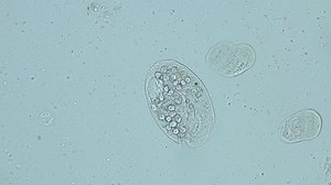clip-1077335039-infusorium-ciliophora-subclass-hypotrichia-under ...