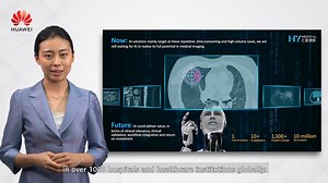 126K views · 559 reactions | HY Medical working with HUAWEI CLOUD transform radiology through All-in-One Medical Imaging AI Solution. Find out more: https://rebrand.ly/partnerpage #hymedical | Huawei Cloud APAC | Facebook