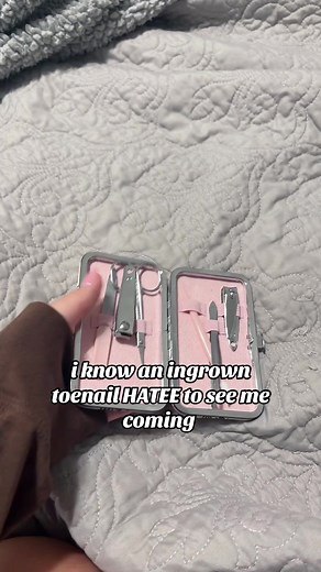 idk why i get them so often but I PROMISE ill get it out before the doctor has to 🎀 #fypシ゚viral #imjustagirl #pedicure