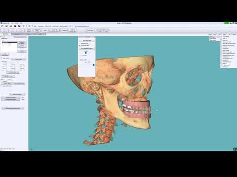 Outsourcing functionality