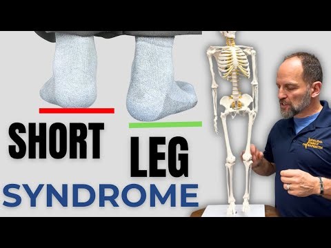 Leg Length Discrepancy, Short Leg, Do I Need A Foot Lift? | Dr. Whitney Wihilidal