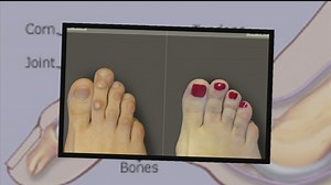 Women go under the knife for Cinderella surgery