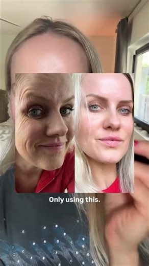 HOW TO LOOK 10 YEARS YOUNGER WITHOUT BOTOX