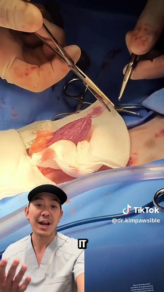 Pro Tip: if you're gonna do a cystotomy wait to culture using the stone, bladder mucosa and urine from surgery! . .questions? . . . #dogs #vetmed #surgery #bladder #stones