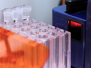 Flow Cytometric Analysis of Natural Killer Cell Lytic Activity in Human Whole Blood