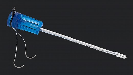 MPFL Repair Using the InternalBrace™ Technique With Knee FiberTak® and SwiveLock® Anchors