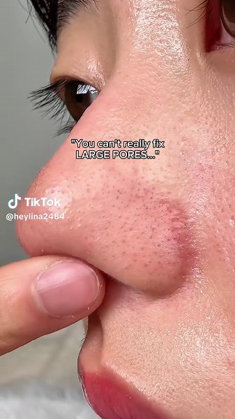 Effective Pore Care Tips Using Clay Masks and Serums