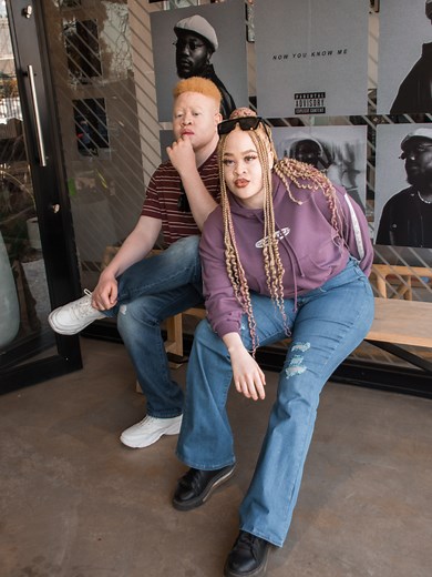 Understanding the Journey of Albinism Twins