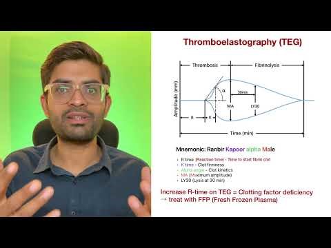 Thromboelastography (TEG) basics — Clear, Simple & High Yield | Dr. Pawan nagar