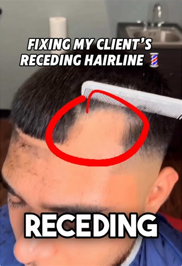 Fixing Receding Hairline: Textured Crop Style Tips