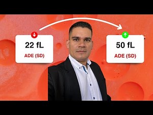 Interpretation of the Red Blood Cell Distribution Width (RBW) in the Complete Blood Count (CBC) o...