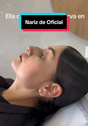 Cirujano Juanes Carmona - Testimonios y resultados de lifting facial y rinoplastia