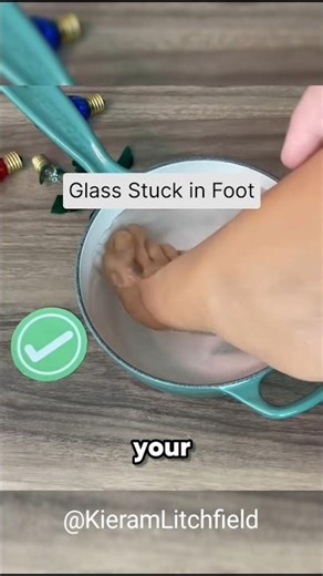 What should you do if a piece of glass gets stuck in your foot?#shorts