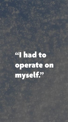 The Surgeon Who Removed His Own Appendix