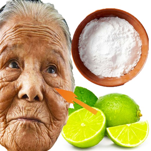 8.4K views · 196 reactions | Lemon has a high acidic content and can be an effective solution to brighten your skin tone, lighten dark spots, treat acne, prevent premature signs of aging, among others. It is an age-old home remedy for different skin concerns. However, lemon may cause side effects like burning sensation, irritation, etc. | Health Tips | Facebook