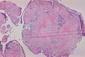 アポトーシスと壊死-違いと比較 - ブログ 2025