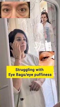 Say Goodbye to Under Eye Bags Forever! #EyeBag #SkincareSecret #FaceFitness #NaturalBeauty #PuffyEye