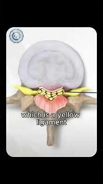 MILD Procedure: A minimally invasive treatment at New Jersey Spine and Pain Institute