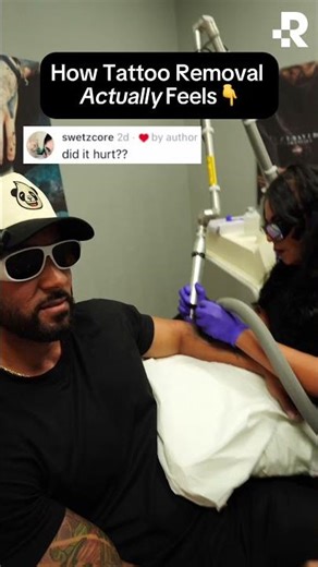 Does Tattoo Removal Hurt? #removery