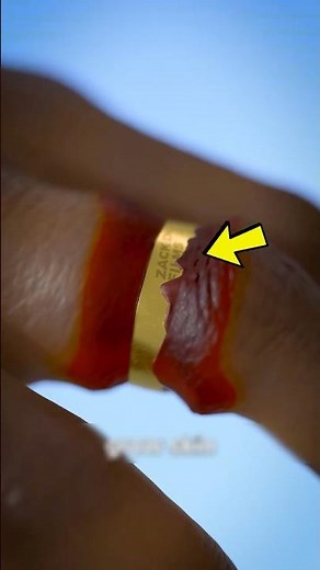 That’s Why Your Fingers Swell Even More!? 😲