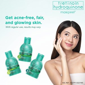 10K views · 88 reactions | Gusto mo malaman how Maxi-Peel works?...