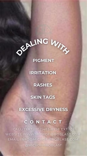 MicroFibroBlast (@microfibroblast)’s videos with Glow - Galea Iustin-Silviu