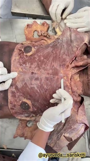“Origin & Insertion of Pectoralis Major Muscle 🔥#ayurved #BAMS